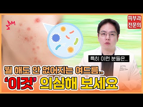 여드름인 줄 알고 치료했다가 오히려 악화되는 '이 질환'｜피부과 전문의가 알려드립니다(체크리스트 있음)