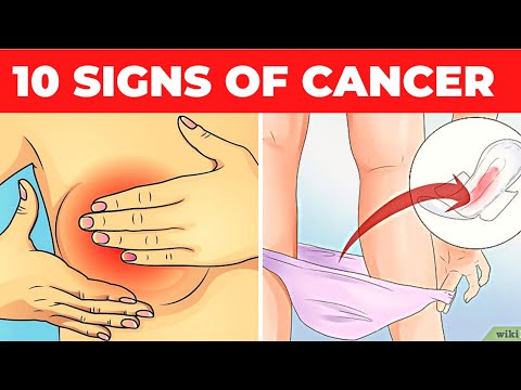 10 Early Signs of Cancer Mostly Ignored By Women