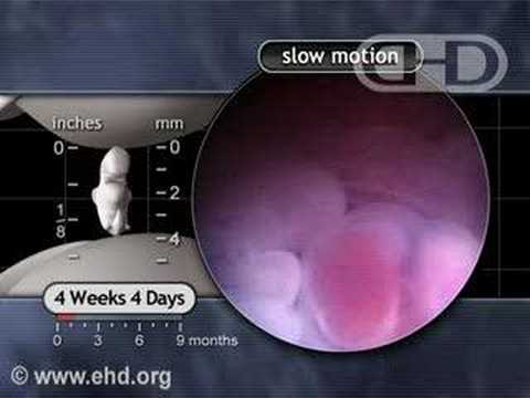 The Beating Heart in Slow Motion: 4 1/2 Weeks Pregnant