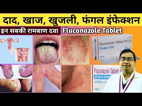 दाद, खाज, खुजली की दवा | Fluconazole Tablets ip 150 mg | Zocon 150 | FCN 150 tablet in Hindi | Fluka