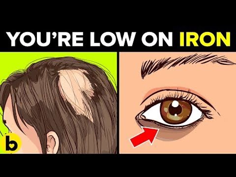 WARNING! 🔥 8 Shocking Signs Your Body is SCREAMING for Iron! 😱