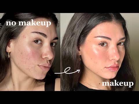 how to fake perfect skin with makeup | acne friendly