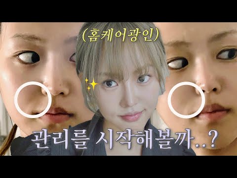 콤플렉스 타파👊🏻홈케어광인's 팔자주름 없애는 법(시술후기,안좋은 습관 등등..)