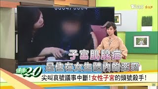 以為生理痛，其實是「子宮肌腺症」 讓你痛到全身發燙、肛痛、脹氣便祕！健康2.0