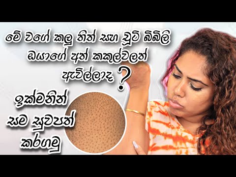 How to cure strawberry skin | Sinhala beauty tips 2023