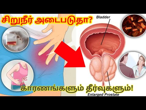 சிறுநீர் அடைபடுதா? | urine block problem in tamil | urine block in tamil  | urine problem tamil