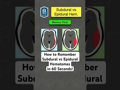 🔥 How to Remember Subdural vs Epidural Hematomas in 60 Seconds! [Nursing]