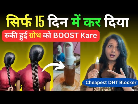 रुकी हुई ग्रंथ को बूस्ट करें सिर्फ 15 दिन में दीय हेयर ग्रोथ  DHT Tonic|| Auro's Beauty Care