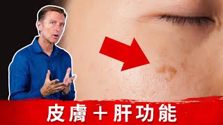 肝9.皮膚9症狀告訴你肝功能不好, 柏格醫生dr berg