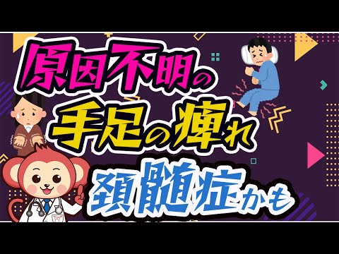 【大注目】原因不明の手足の痺れ、頚髄症かも