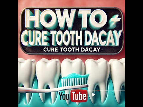 How To Cure Tooth Decay  Reverse Cavity at Home