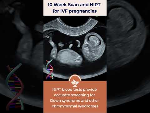 10 Week Scan and NIPT for IVF pregnancies