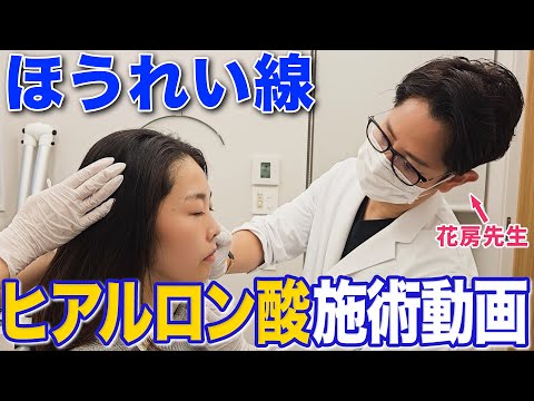 【ほうれい線】ヒアルロン酸注射の施術の様子を大公開！