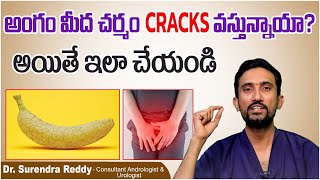 Causes of Penis Foreskin Cracked in Young Ones || Penis Foreskin Cracks || Socialpost Health