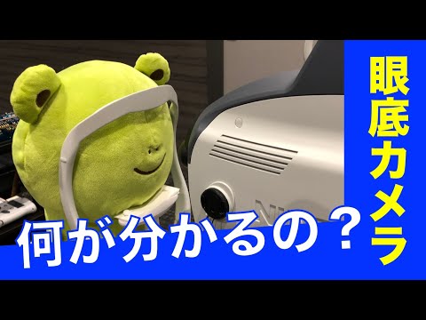 人間ドックの目の検査。どこまで分かる？【眼底カメラ】