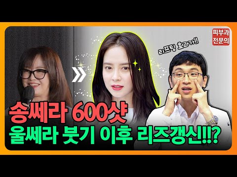 송지효 울쎄라 600샷 전후 보이는 차이👍👍 #울쎄라 #송지효 #600샷