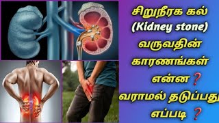 சிறுநீரக கல் (kidney stone) வர காரணங்கள் என்ன❓ வராமல் தடுப்பது எப்படி❓Reason for kidney  stone ❓