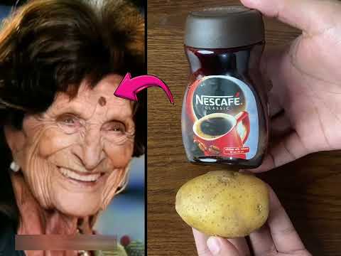 My Mother Is 60 Years Old - We Wipe Her Spots With Potato Mask - Face Lifting and Stop Sagging