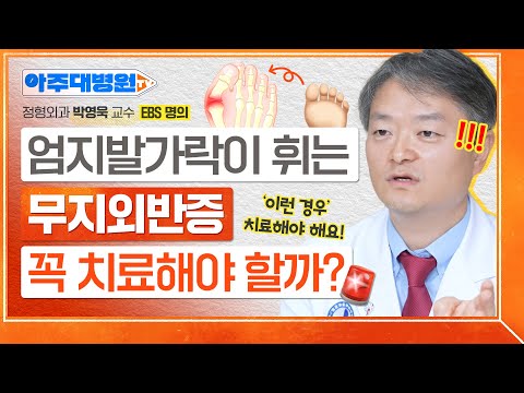 점점 튀어나오는 엄지발가락🦶🏻 ‘무지외반증’의 발병 원리부터 수술, 예방법까지🚨 정형외과 박영욱 교수 [아주대병원TV]