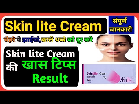 Skin lite Cream की खाश टिप्स, Result l Special tips no scars cream, #cngajbhiye #noscarscream