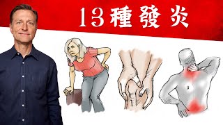 13種發炎,消炎自然療法,柏格醫生 Dr Berg