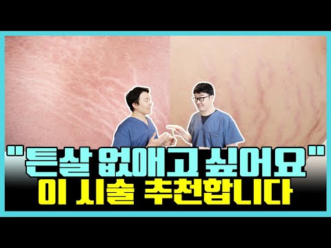 “튼살 없앨 수 있나요?"｜ 튼살 원인, 없애는 방법 알려드리겠습니다! [랜선피부조정 EP. 02]