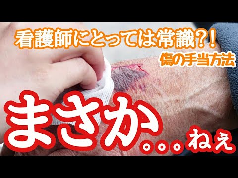 【こどもの手当】湿潤療法について解説する