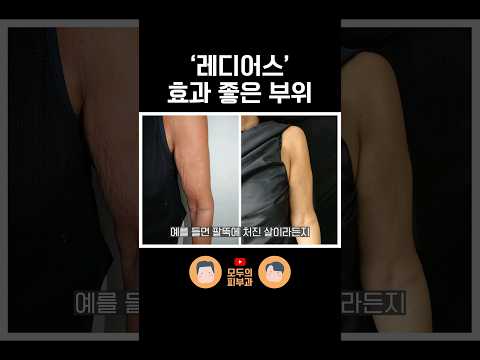 콜라겐 부스터 '레디어스' 어느 부위에 효과가 좋을까?