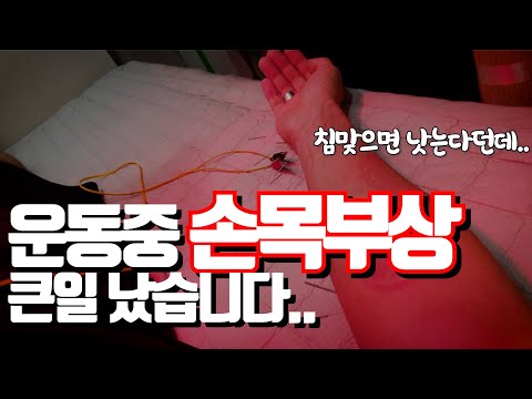 운동하다가 손목부상 입었습니다..상체운동 전면 중단..한의원 전기침, 전자뜸 효과? 손목치료 과정! 앞으로 도전에 대한 계획! 아 운동하고 싶다..[두꼽이챌린지]란쵸 오내나