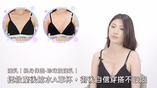 隆乳｜終身保固-珍珠波隆乳｜拯救產後縮水A罩杯，術後自信穿搭不設限