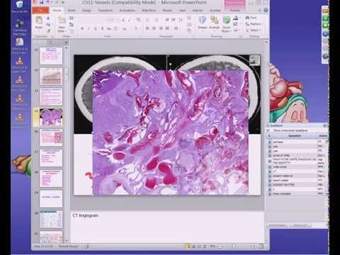 Medical School Pathology, 2013 Season, Session #45: Blood Vessels-I