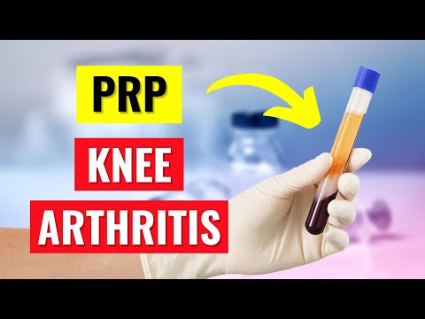 Discover the Power of PRP Injections for Knee Arthritis