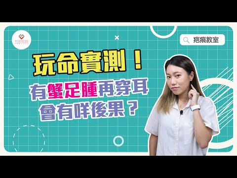 【疤痕教室】EP8 蟹足腫也能穿耳洞？｜專科醫生分享護理心得｜避免穿耳後發炎感染三個小技巧