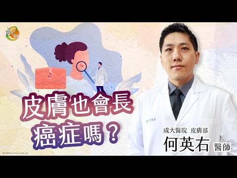 【皮膚也會長癌症嗎？】何英右醫師-成大e學堂