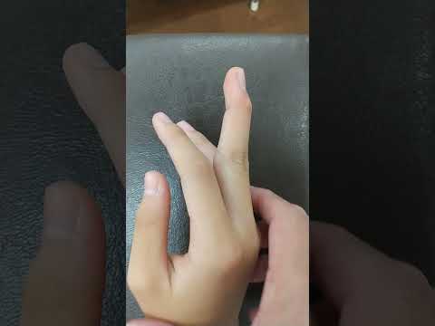 マレットフィンガー疑　春日部　ときだ接骨院鍼灸院  mallet finger