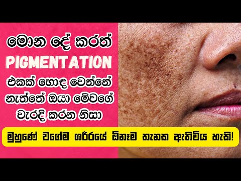 Must do things when treating a pigmentation | Pigmentation treatments | Sinhala Beauty Tips 2023