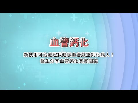 血管鈣化 新技術可治療冠狀動脈血管嚴重鈣化病人！醫生分享血管鈣化真實個案