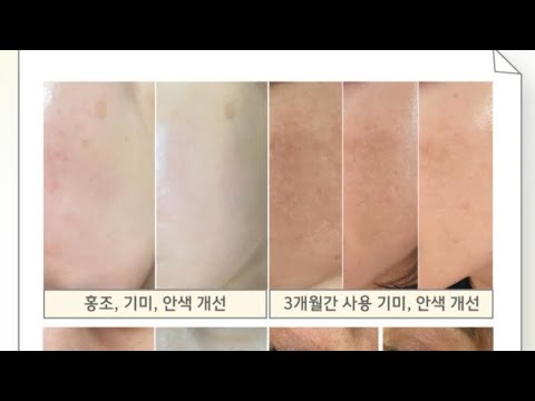 🎊한가위 같기만 하여라~15%첫할인🎊🚫저혈압팩선물잔치🚫오픈런!!