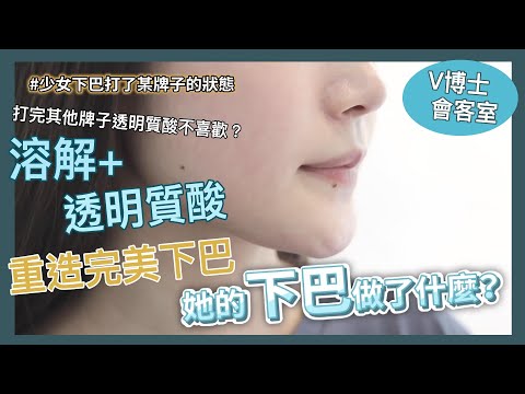 【V博士會客室】EP03 打完其他牌子的透明質酸不喜歡？！溶解+透明質酸～少女重造完美下巴～✨