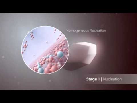 Kidney Stones in the Process of Formation in the Kidneys