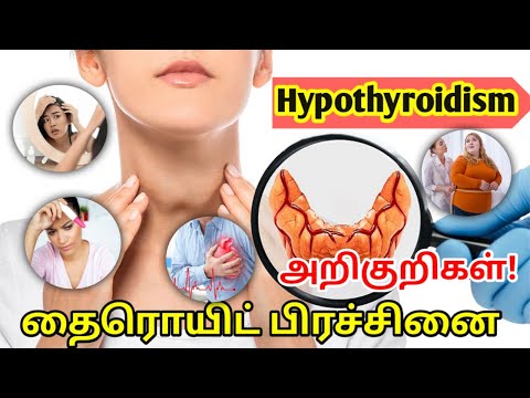 Thyroid symptoms in tamil/Hypothyroidism symptoms in tamil/thyroid problems in women tamil/TSH Test