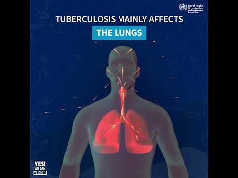 Do you know what is #tuberculosis or TB? || WHO Bangladesh