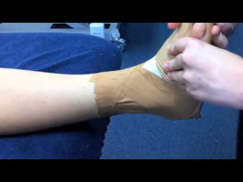 How to Tape an Ankle - Presented by Pivotal Motion Physiotherapy