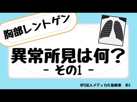 胸部レントゲンで見える異常所見は何？その1