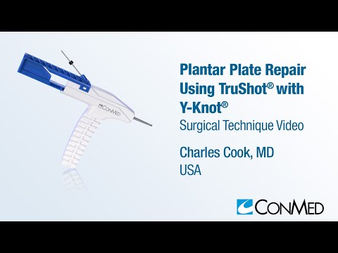 Dr. Charles Cook - Plantar Plate Repair Using TruShot® with Y-Knot® - CONMED Surgical Technique