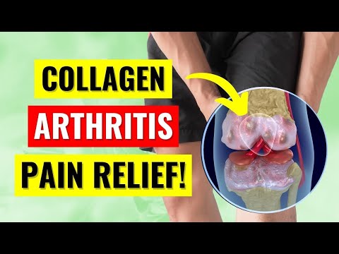 The Truth About Collagen for Arthritis Pain