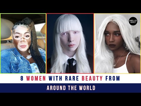 8 Women With Rare Beauty From Around The World