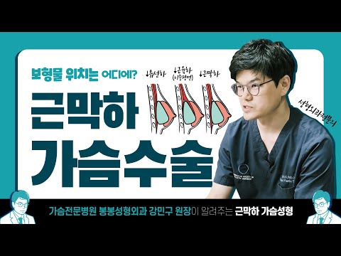 가슴 수술 시 보형물 넣는 위치는? 근막하 가슴성형 팩트체크!