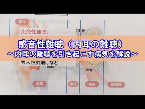 感音性難聴（内耳の難聴）～内耳の難聴を引き起こす病気を解説～