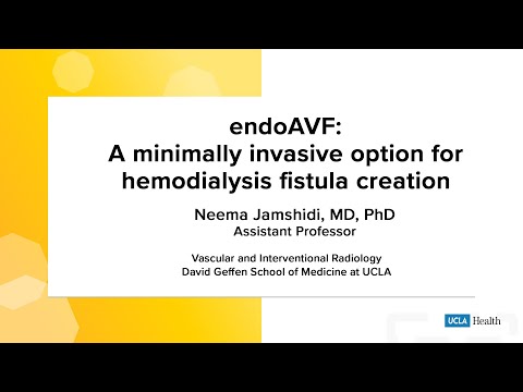 endoAVF: A minimally invasive option for hemodialysis fistula creation | UCLA Health